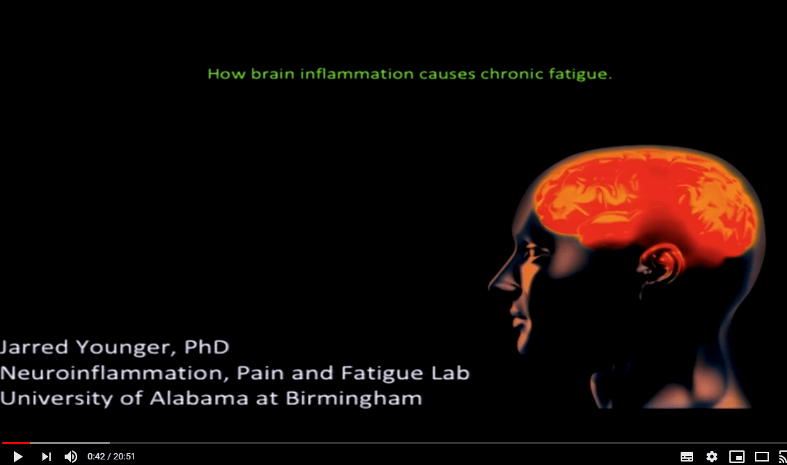 La Inflamación Cerebral Causa Síndrome De Fatiga Crónica SFC – → Domina ...